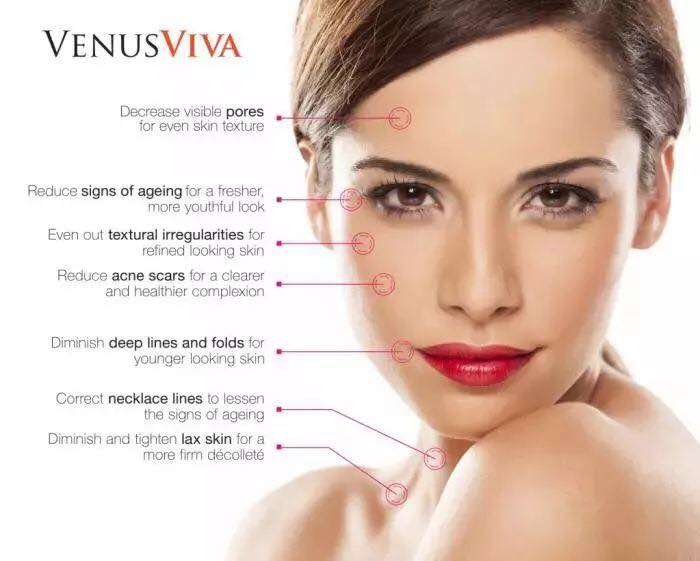 Venus Viva Nano Fractional Radio Frequency Skin Resurfacing for Face & Neck